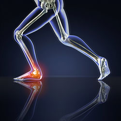 High Res 3D Rendering of Running Man, Ankle Pain (Poser, Maya, Photoshop)